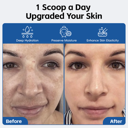 Hyaluronic Acid Powder, with Collagen Peptides
